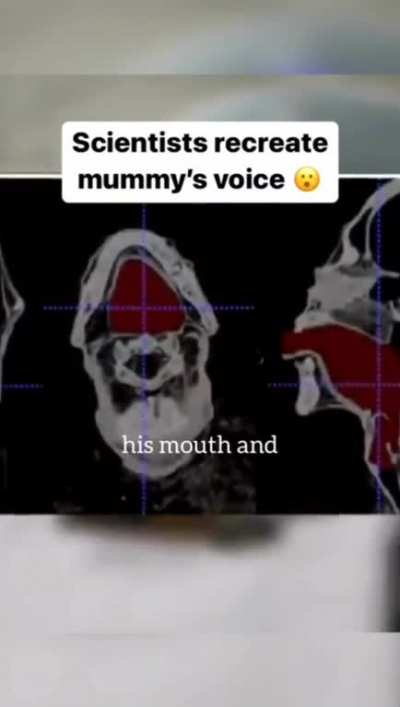 Mindblowing🤯