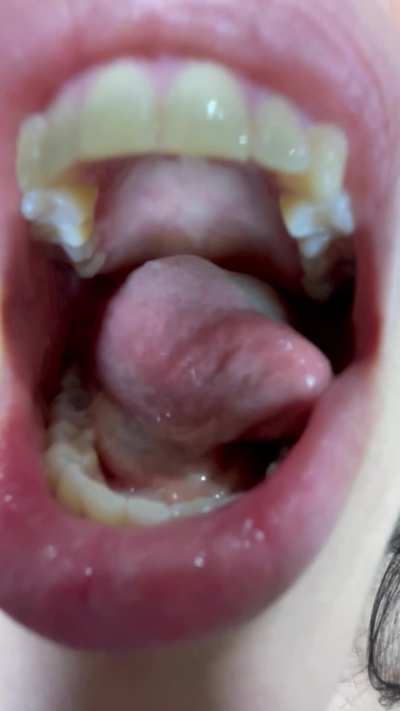 Ups i eat you