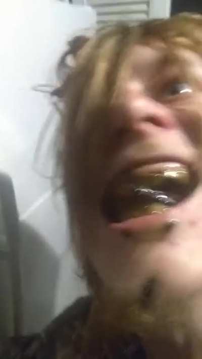 Local Suboxone junkie dubbed "scum" consumes a cocktail of mexican brick opium and robotussin