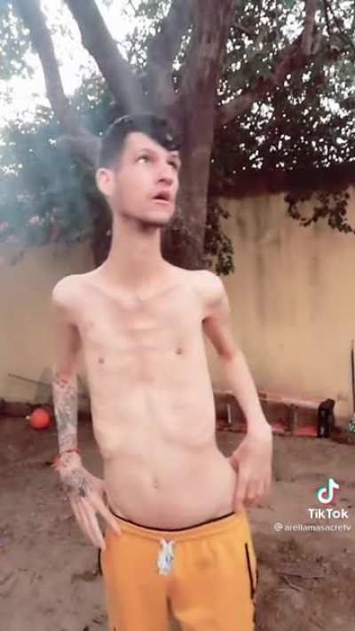 If you think you are thin watch this video