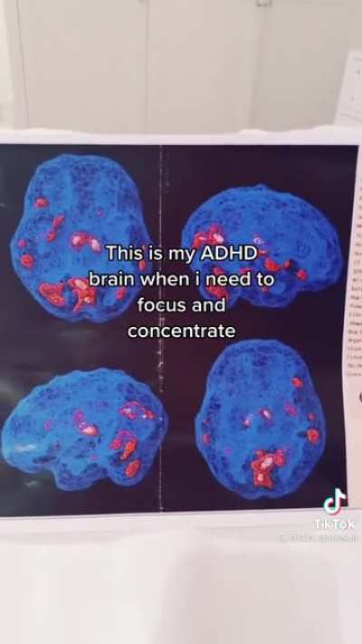 Not really a meme, but still important