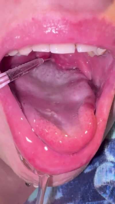 First time with water flosser 😭