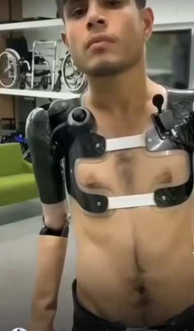 New prosthetics are amazing