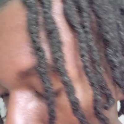 Updated: 10 months. Patterns still viewable. Do they look healthy?