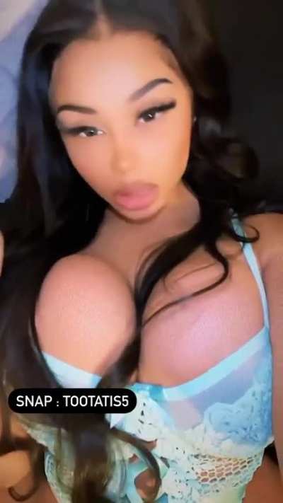 💎