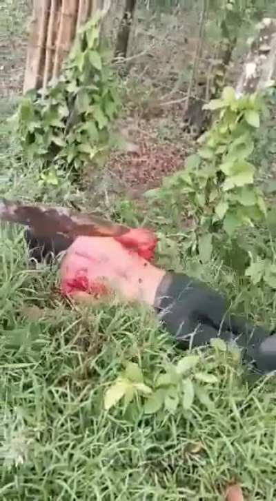 #11 ALL OF them from r/eyeblech r/MakeMyCoffin r/NSFL__