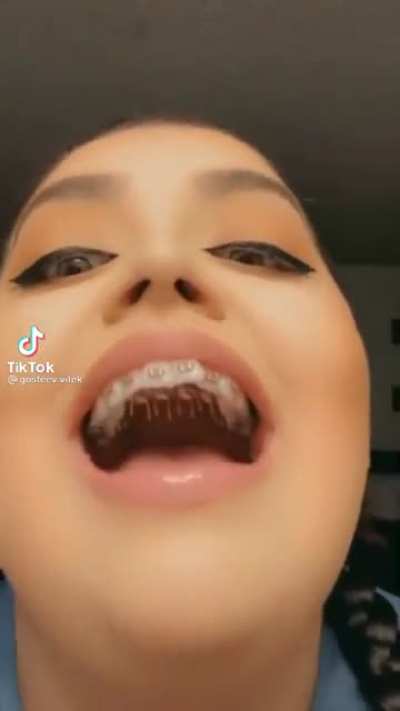 Special braces