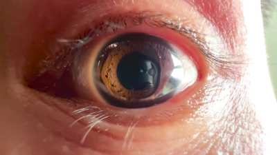 Dilate pupils on command