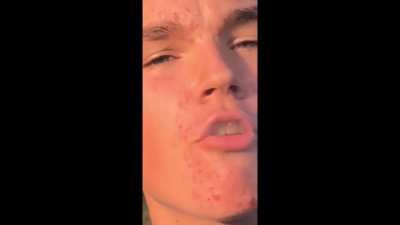 Eating dry ice
