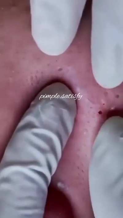 ...........