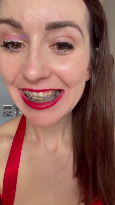 I love my braces because I have unusual bracket which I&rsquo;ve not yet seen on another girl 