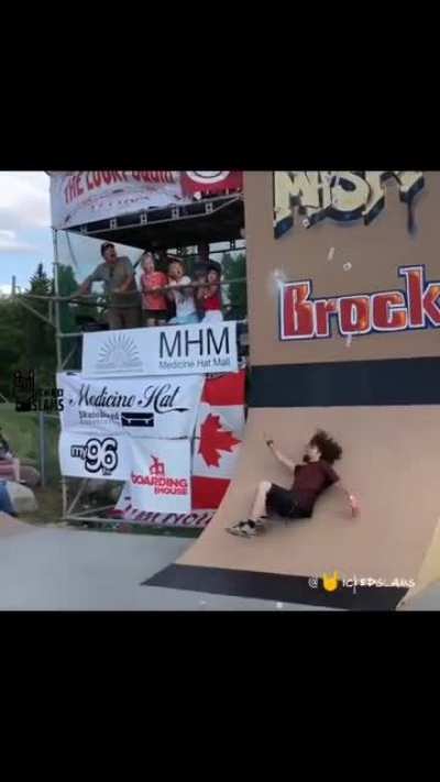 HMFT after my skateboard flies back to orbit on my face