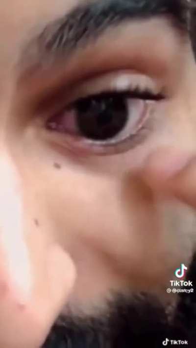 Eye poppin