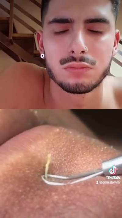 TIHI