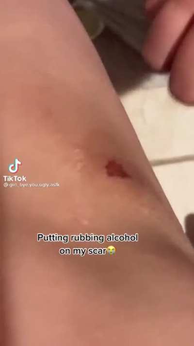 It doesn&rsquo;t hur-....AHHHHHH