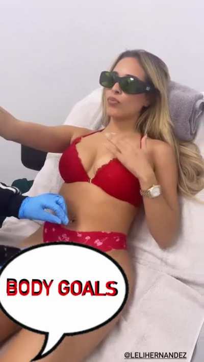 Laser removal