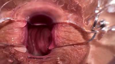 New video! Look inside my tight asshole. Anal speculum. Opened holes orgasm. Links in comment