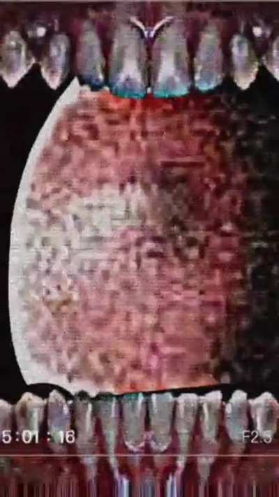 this footage was extracted from a person's house after the fog came, the body of the victim is full of scratches and holes