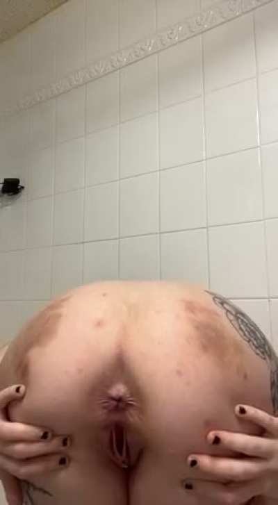 The bruises are from a BDSM party I went to, don’t worry ;)