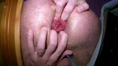 Here's how Prolapsevillians use a cockring...