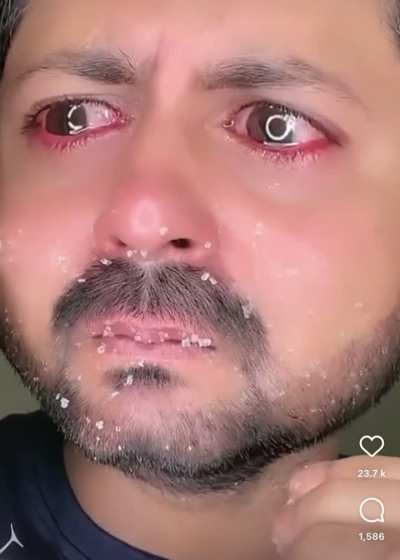 What is that on his face and wtf is this video?