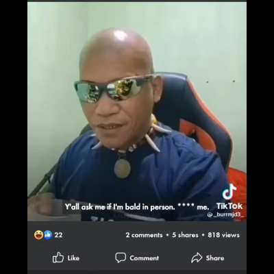 "Kalbo po ba kayo sa personal?". 🇵🇭 (Are you bald in person?).