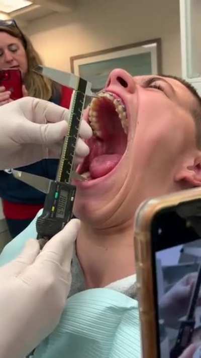 This guy's ability to open his mouth
