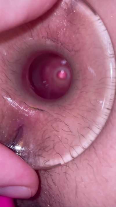 My ass hole was so hot, he had to put some ice in it for me