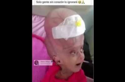 XD
