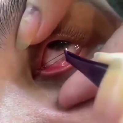Eye don't like this