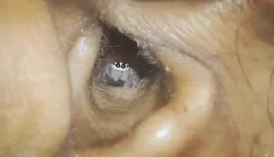 This spider in an ear