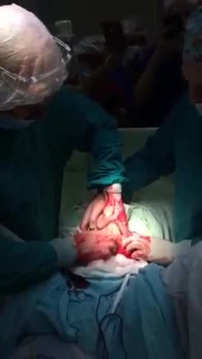 Surgery situation