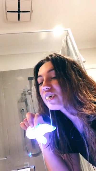 Drooling from teeth whitener