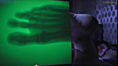 Exposing your hands and feet to 40 Sv/hr of X-rays, also touching badly shielded high voltage, and wearing pure lead without protection. They still post videos to this day of stupid experiments like this.