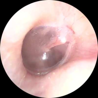 Another Ear Rumble Video