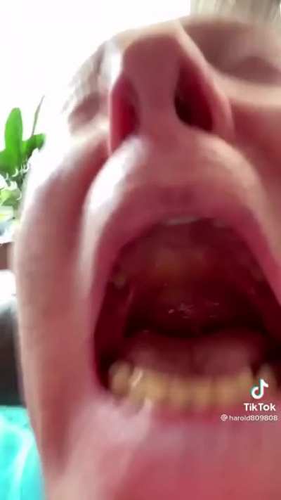 Un montón