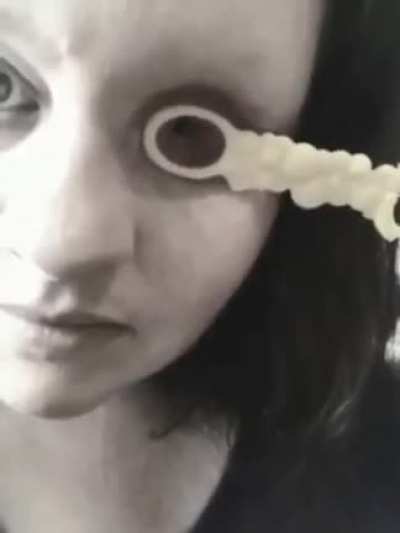 Physical cringe: after eye surgery she got blow bubbles through her eye socket