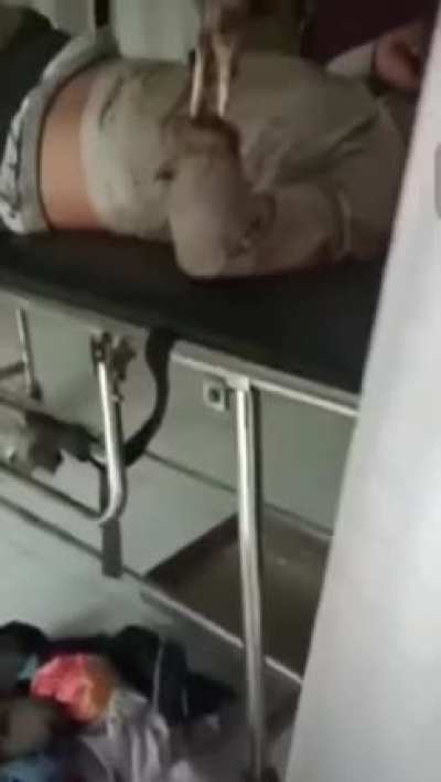 Fried To The Bone By Electricity (WARNING: VERY GRAPHIC CONTENT)