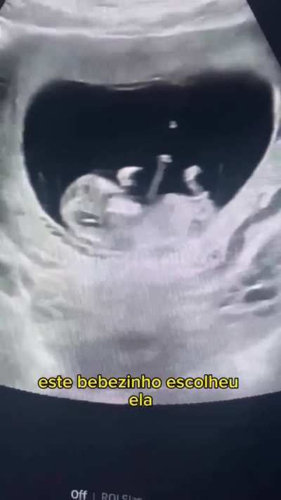 Pessoas que tiveram um dia pior que o seu