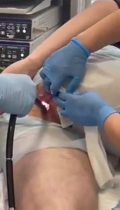 Doctor Pulling Out Cucumber From Man&rsquo;s Butt