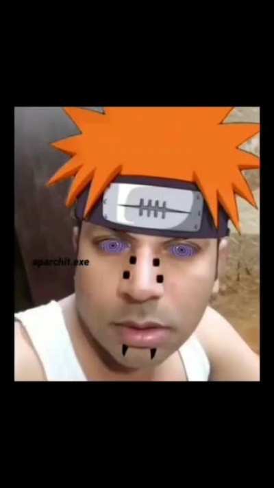 Pain Babu 💔