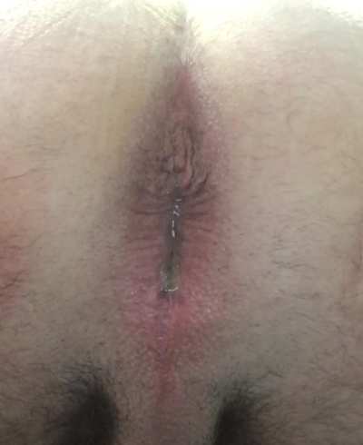 Juiced up hole