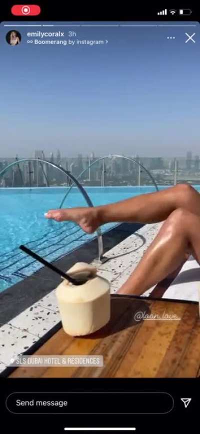 Legs