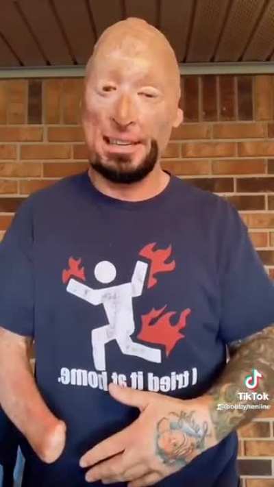 &ldquo;Hey Smoothskin, Never Seen A Ghoul Before?&rdquo; In all seriousness this guy even with his disability seems to have a great sense of humor. Hope he&rsquo;s doing well.