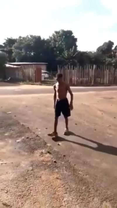 Ta pouha Vinicius(ai meu dente man)
