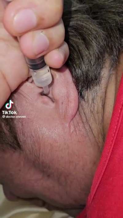 Satisfying ear cleaning