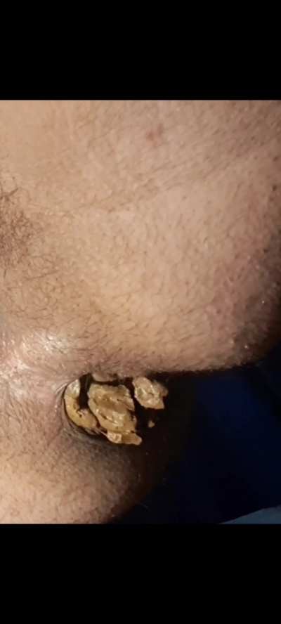 (F) huge turd for u today