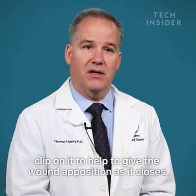 Needle-less alternative to traditional stitching of wounds