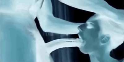 X-Ray’ted