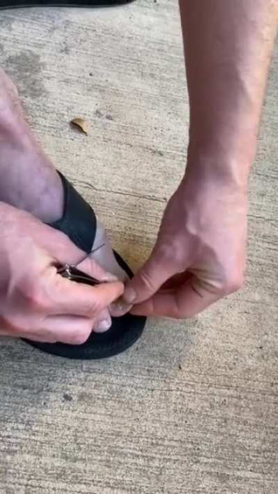 Took a toenail off today. F for my wife.
